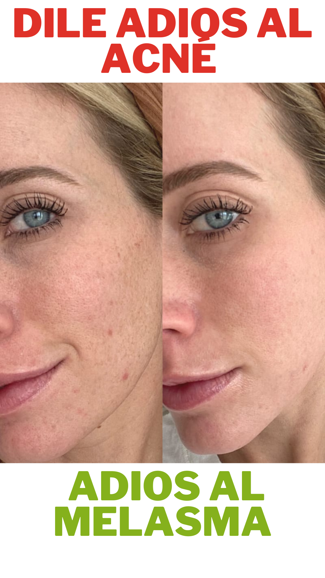 Bio Serum Facial